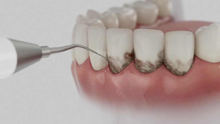 Reliable Dental Implants contractor in Flower Mound, TX by Smile Center Dentistry